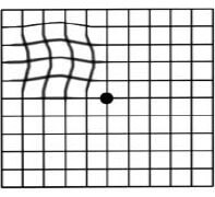 The Amsler Grid